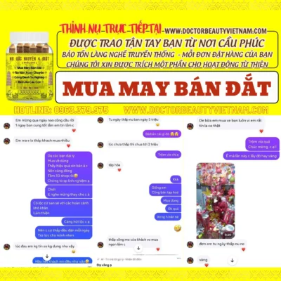 nụ ước nguyện 4 mặt mua may bán đắt